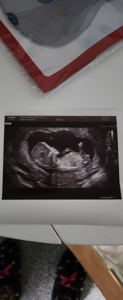 A line eye enthusiast #2