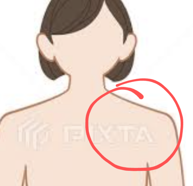 Shoulder/collarbone pain. Help