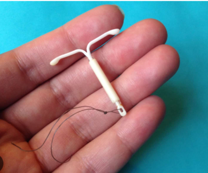 IUD only 1 string and weird pains