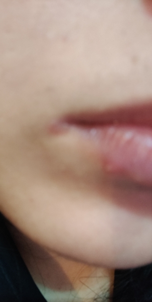 Is this a pregnancy symptom?