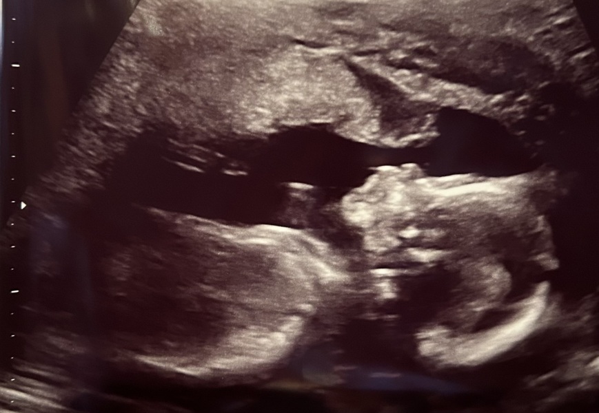 Due May 2024? Part 2