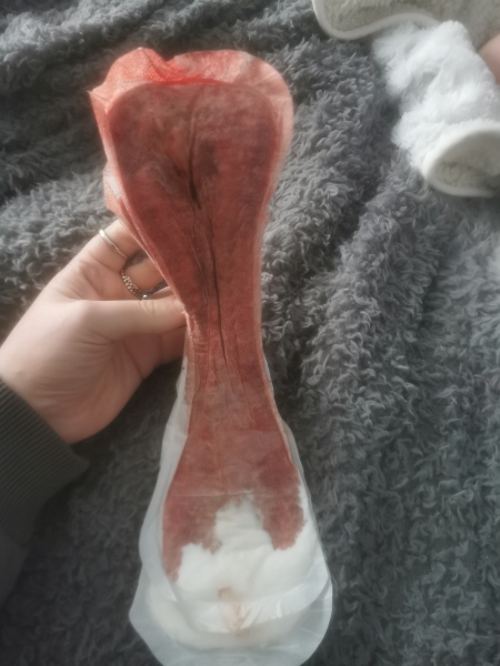 Desogestrel 1 month after birth