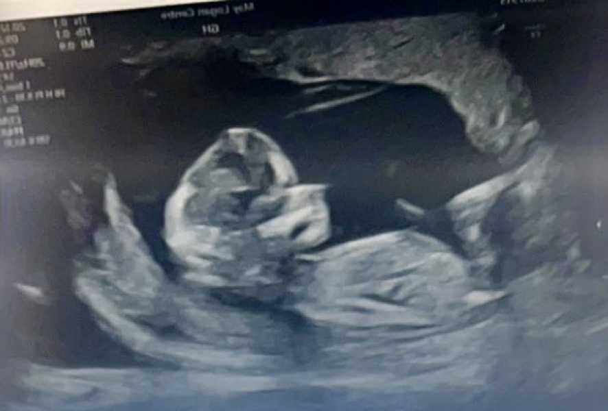 Baby gender please?