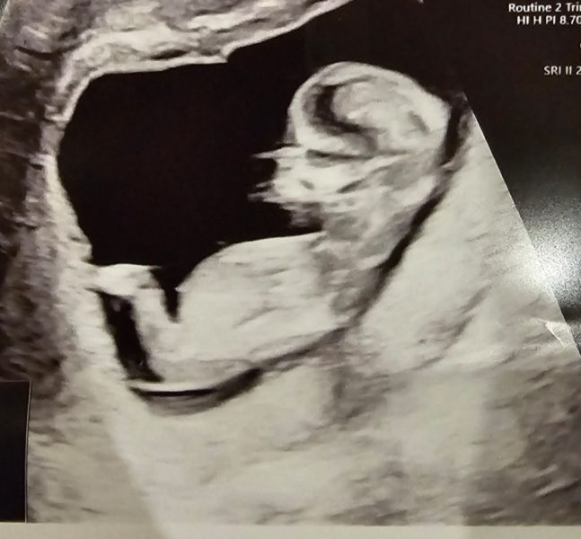 Any guesses?