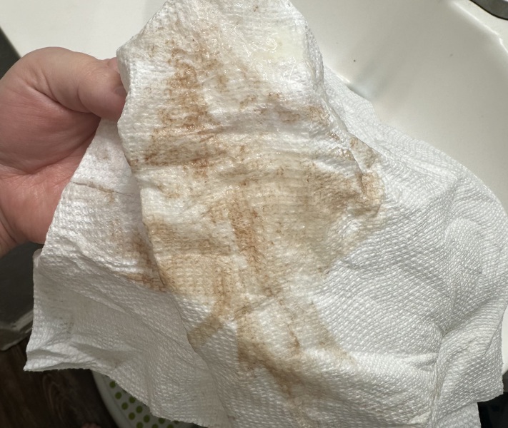 Am I miscarrying? TW:blood