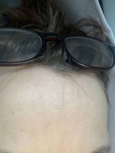 How do you keep looking young ?
