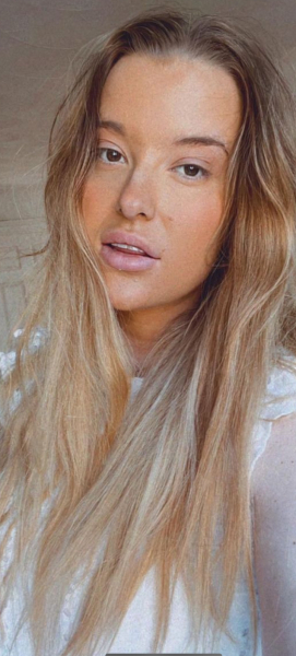 Lip fillers?