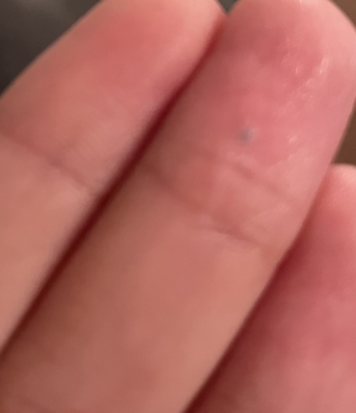 Small black dot under finger?