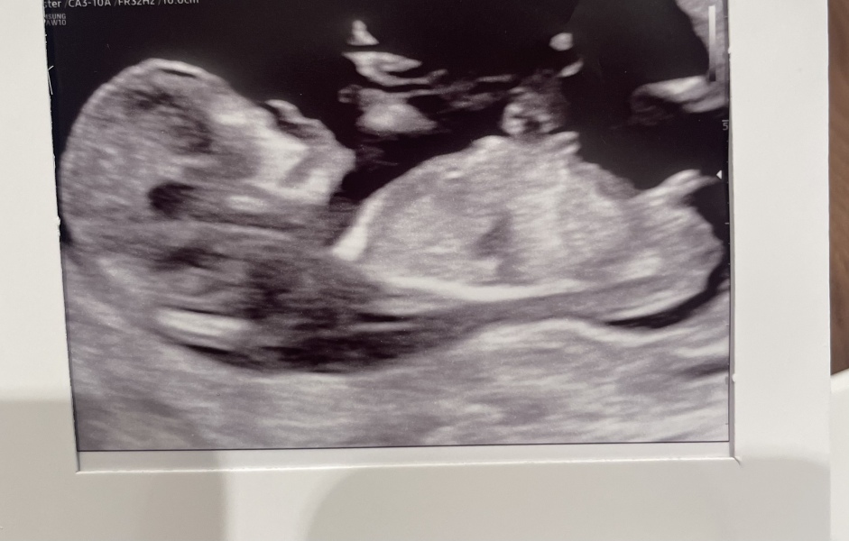 Boy or girl??