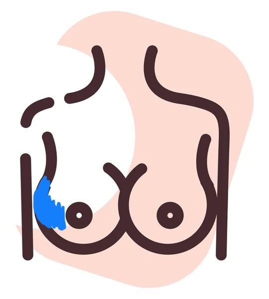 OUCH! My boobs! OUCH!