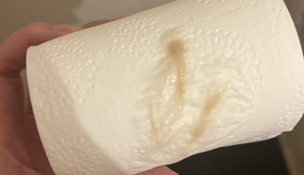 Chest infection viral or not?