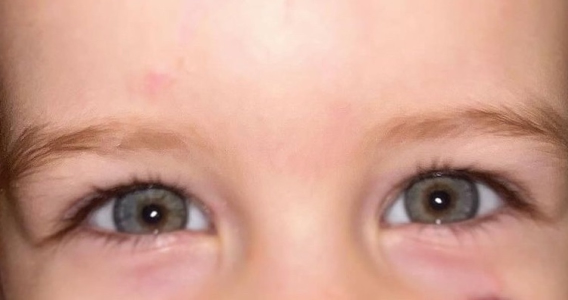 What colour are these eyes? (Pic)