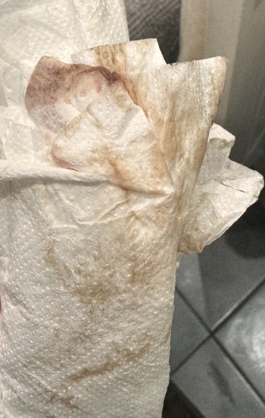 Implantation bleeding