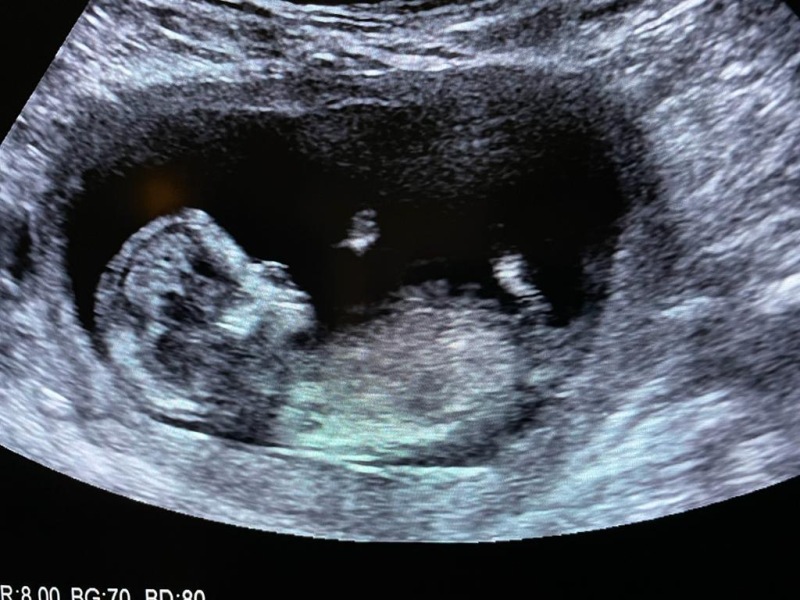 Due June 24 💚 - Part 2