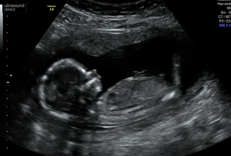Girl? Boy? Alien?!