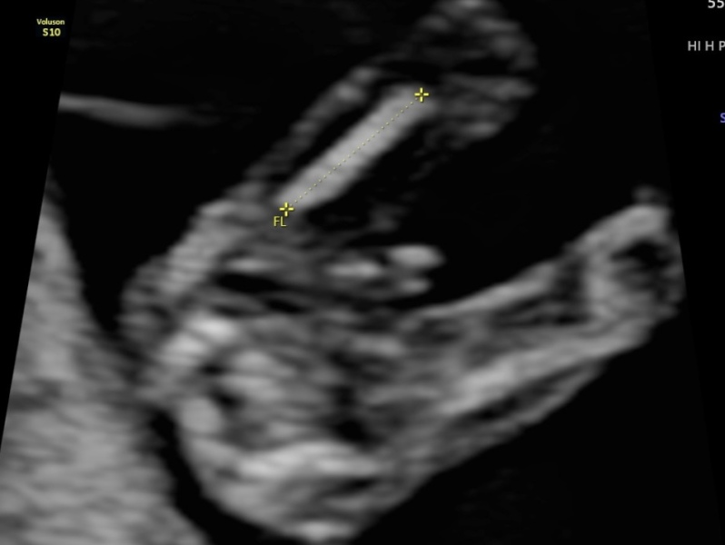 Nub theory - confused by scan