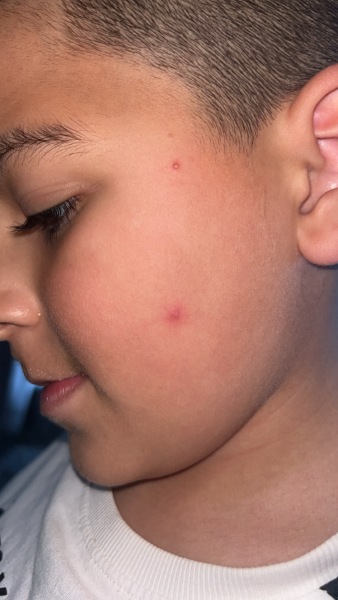 Could this be chicken pox or any idea what else it could be