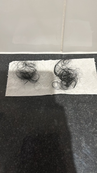 Losing my hair