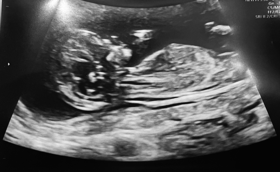 Due June 24 💚 - Part 2