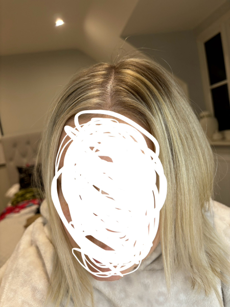 Are these highlights normal? Pic included.