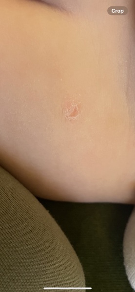 What is this? Is it ringworm? Or something else?