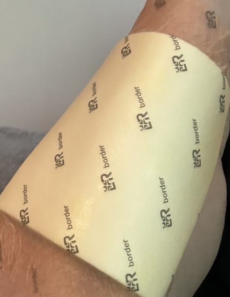 TW SELF HARM. Is this infected