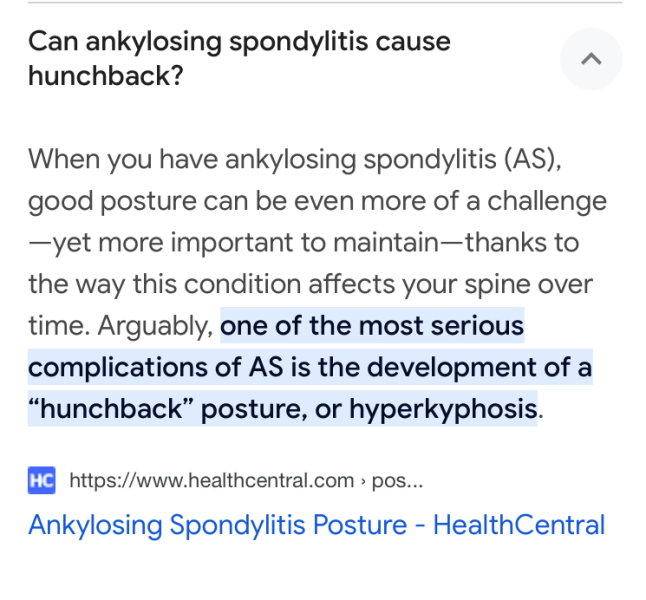 Is slouching a problem? Health wise? Or just appearance?