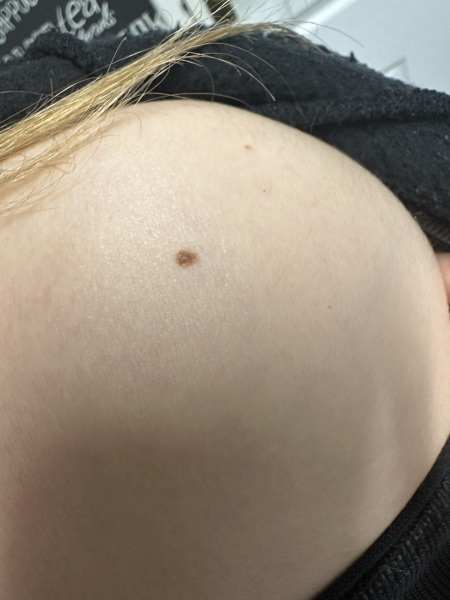 Moles