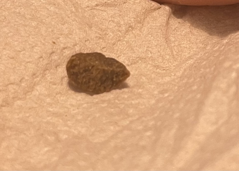 What are these weird things?