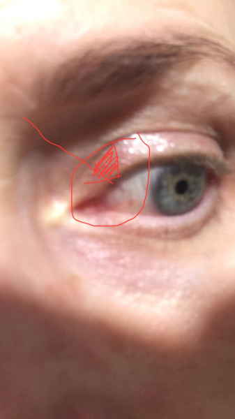 Talk me down - my eye looks weird ...