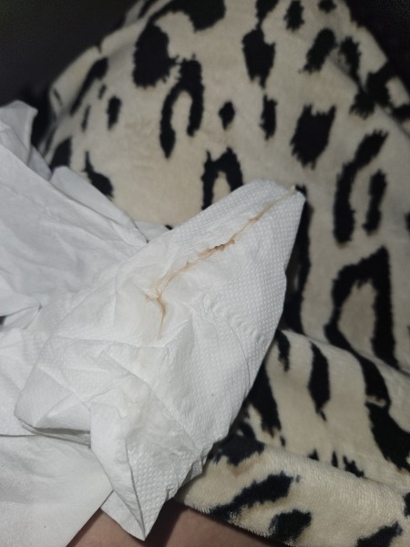 5 weeks pregnant with this discharge this this normal?