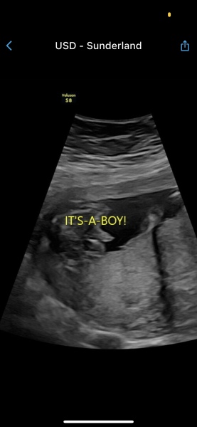 Potty shot 17 weeks