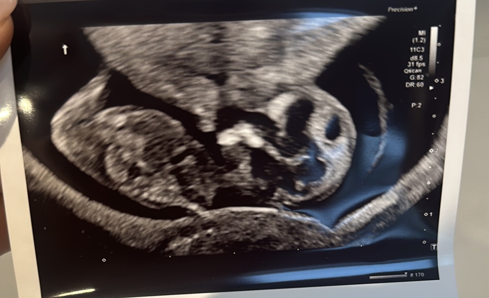 Boy or girl? Gender guess (just for fun)