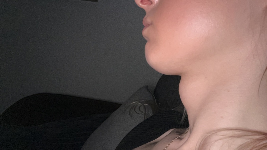 Lump on neck