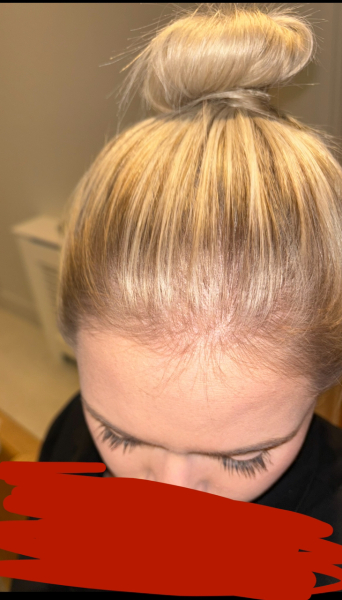 Are these highlights normal? Pic included.