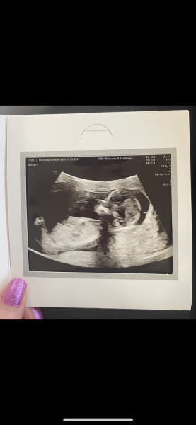 Gender guess?