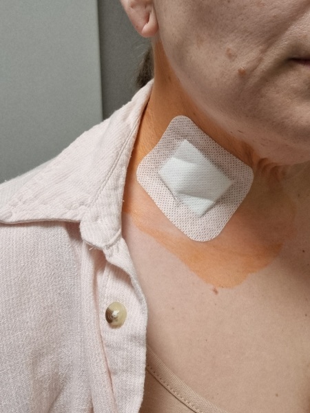 Thyroid cancer?