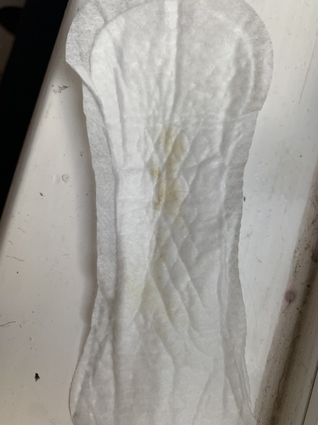 Discharge graphic image warning!
