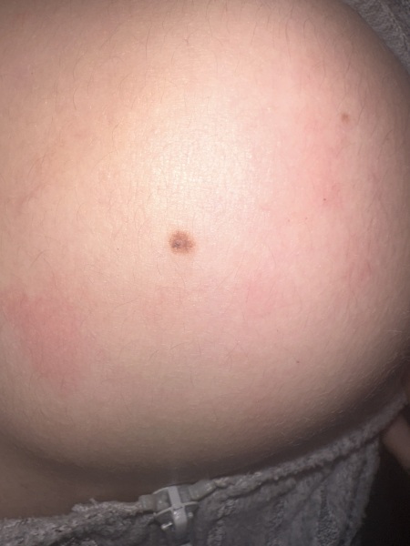 Mole