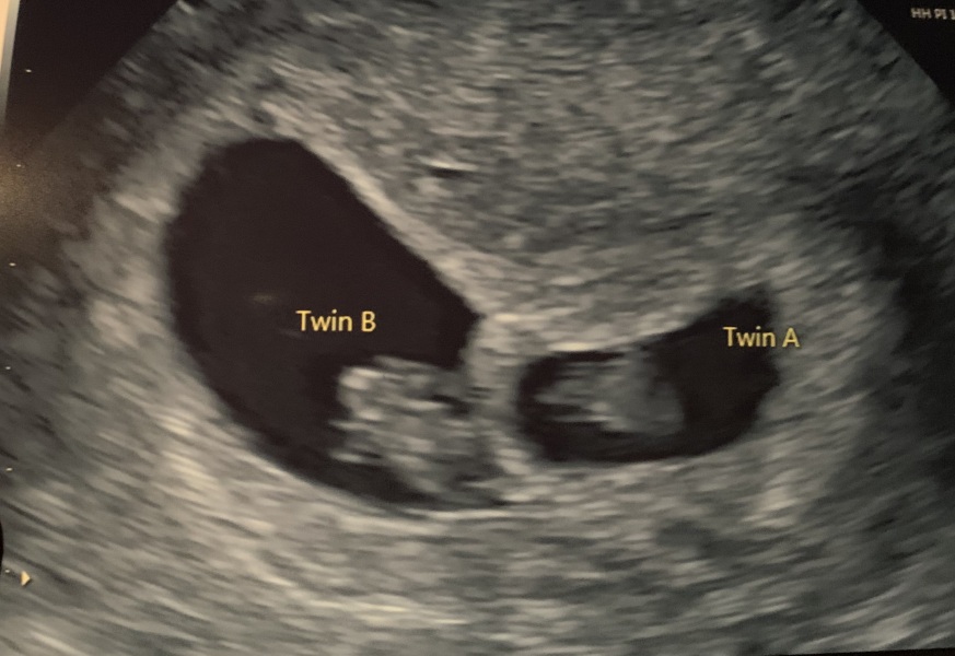 Due August 2024!