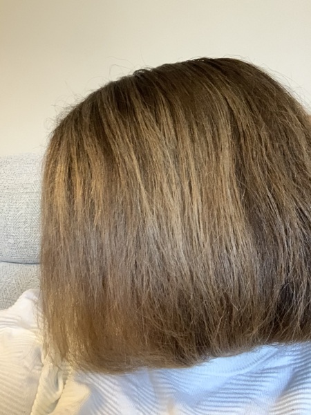 To embrace the grey at 37?
