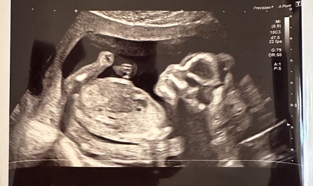 Girl or Boy 💖💙