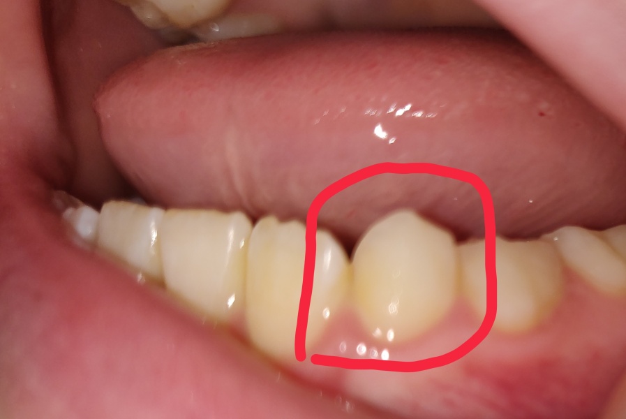 Is this a wobbly child or adult tooth? (Photo attached)