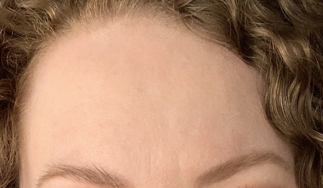 How do you keep looking young ?