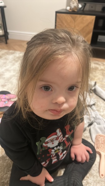 Downs syndrome parenting experience 