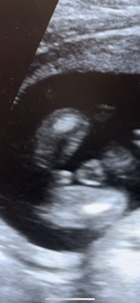 accurate gender?