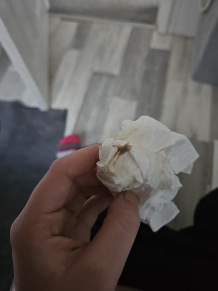 5 weeks pregnant with this discharge this this normal?