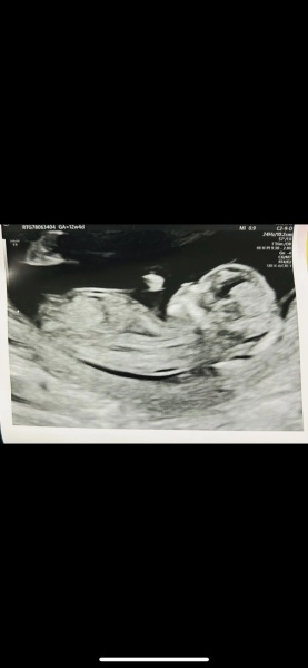 Nub theory guess 12 weeks