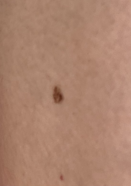 Moles