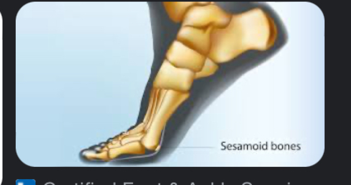 What is this a picture of?  (On a Nike t-shirt)